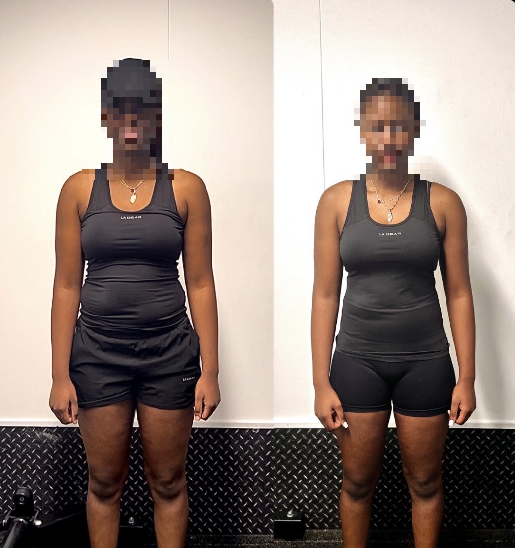 Before and after — 10-day method (face hidden for privacy)