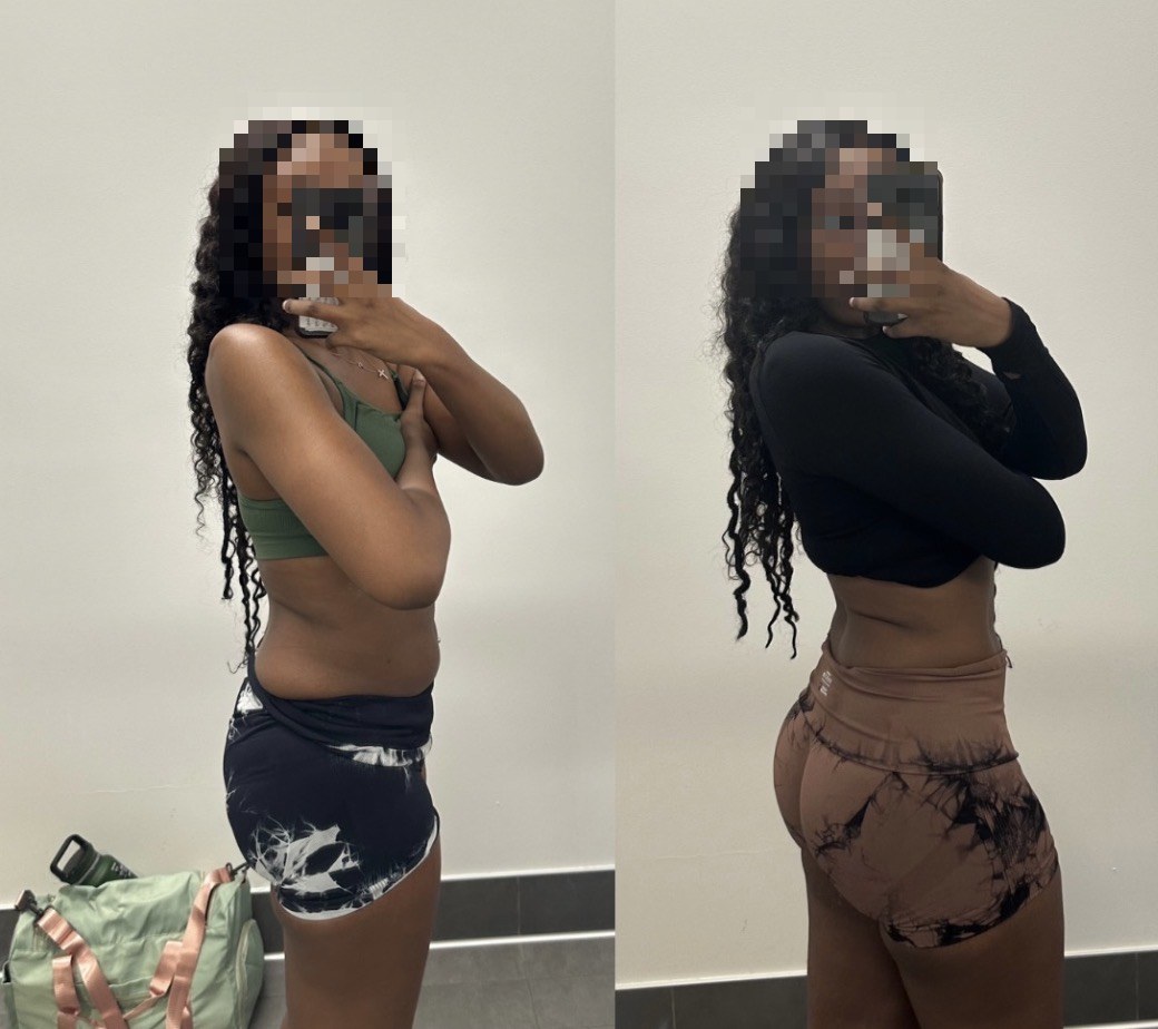 Before and after — 10-day method (face hidden for privacy)